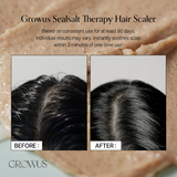 Sea Salt Therapy Scalp Scaler