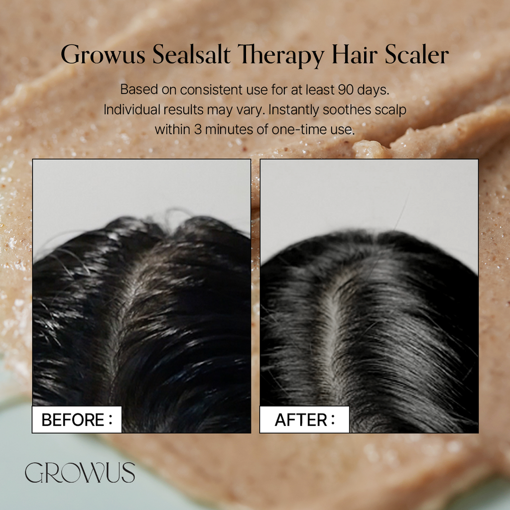 Sea Salt Therapy Scalp Scaler (250g / 8.81 oz.)